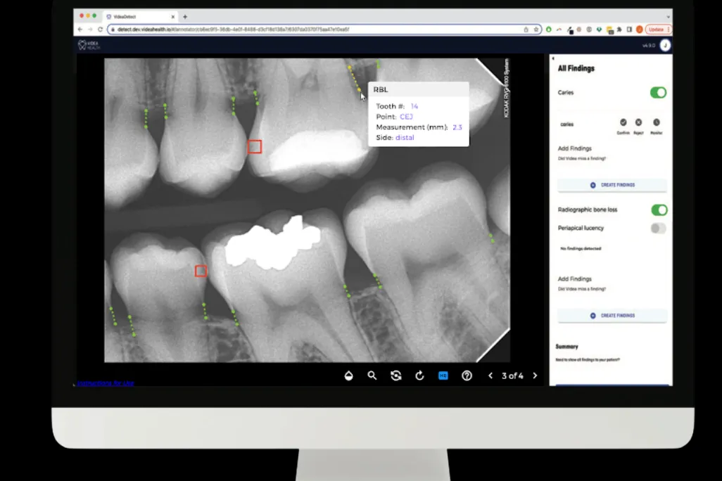 The VideaHealth AI platform `