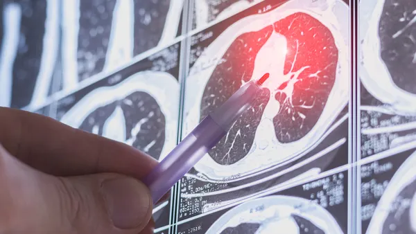 A person points to a CT scan of the lungs using a pen.