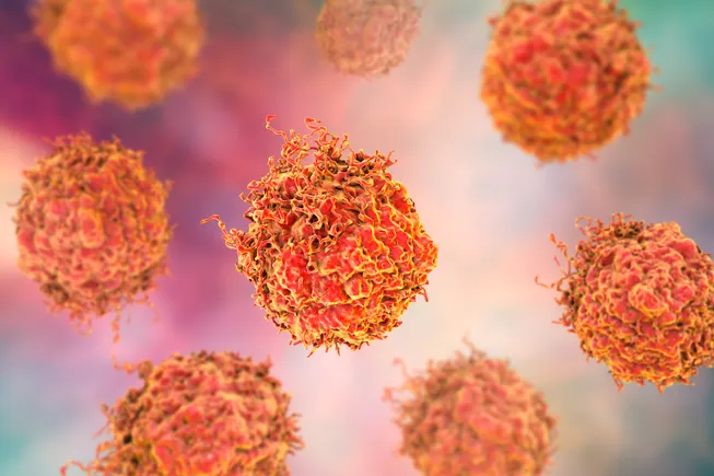 J&J data support earlier use of combo pill in prostate cancer