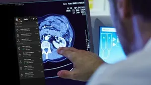 A person points to a scan on a screen.