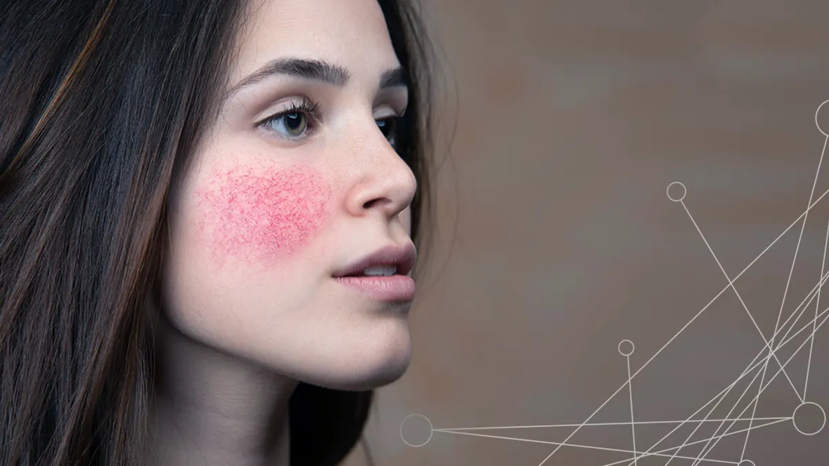 Young woman with inflamed red cheeks