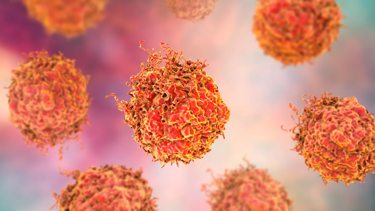 Prostate cancer cells, 3D illustration. Prostate cancer awareness image