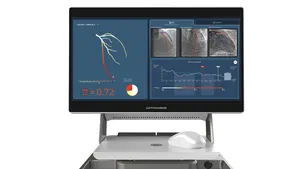 The CathWorks FFRangio System on a cart.