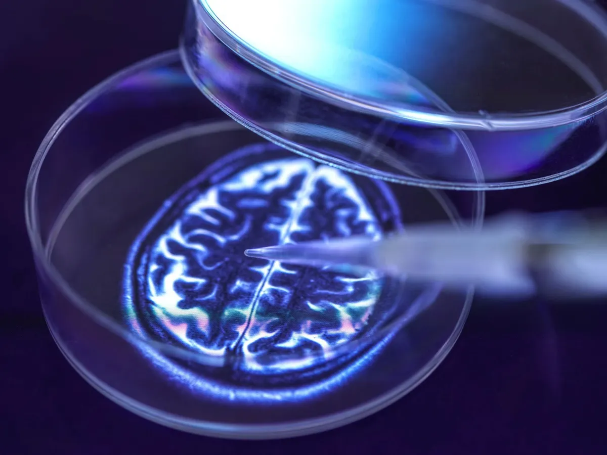 parkinson's disease retatrutide clinical trial Reta data & dosing — a must read (Reta) isn't just another GLP-1. It's a triple-agonist peptide studied in Phase 3 trials for metabolic health — targeting GLP-1, GIP Researchers evaluate a pipeline of