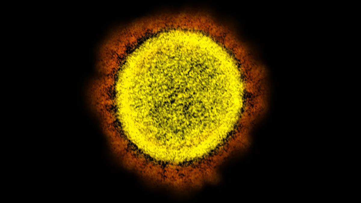 Transmission electron micrograph of SARS-CoV-2 virus particles, isolated from a patient.