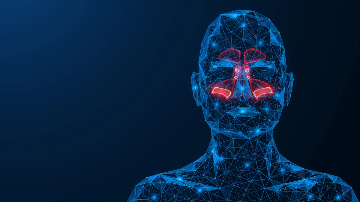 Purulent inflammation of the para nasal sinuses.