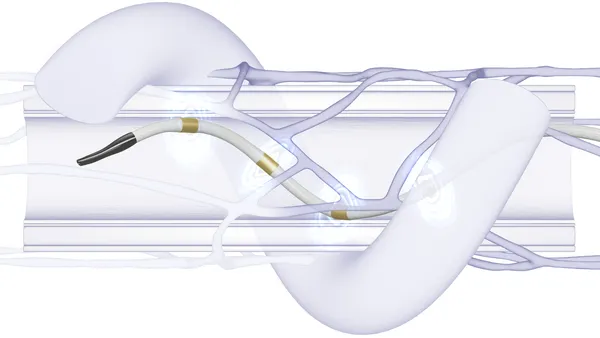 A coil-shaped device is shown moving through a tube with branching structures around it.