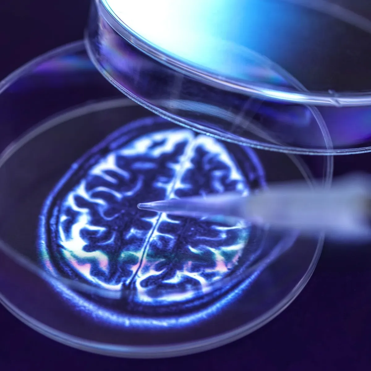 parkinson's disease retatrutide clinical trial Retatrutide, an experimental drug currently in Phase 3 clinical trials, is nicknamed retatrutide parkinson's clinical trial Effects  Unapproved weight loss drug retatrutide