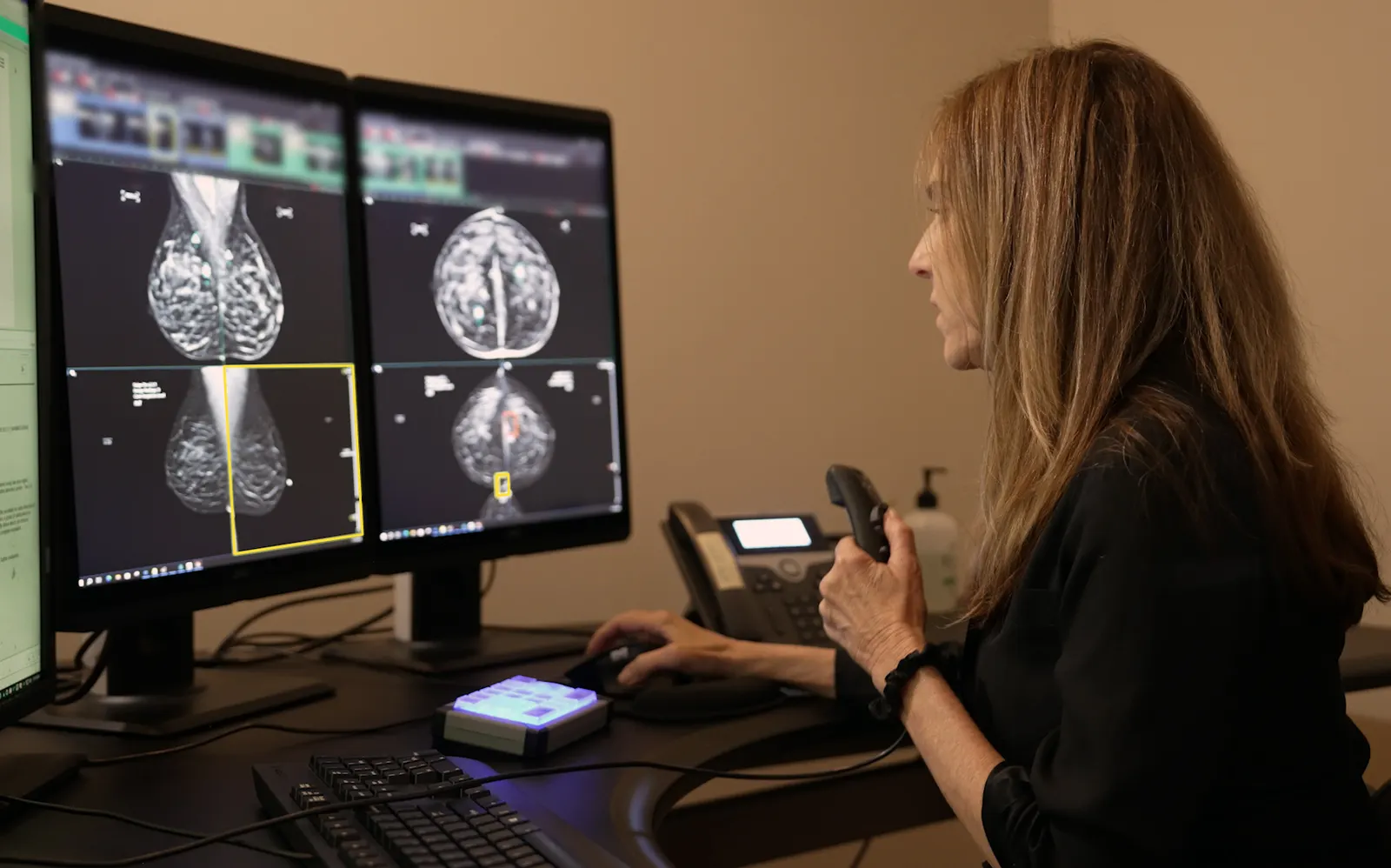 A picture of a women looking at mammography images on a computer in an office setting.