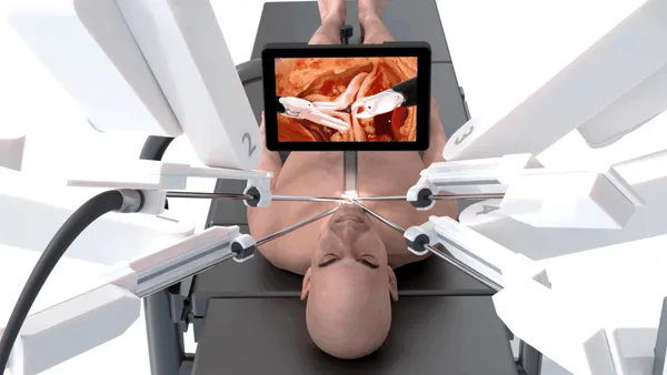 A robotic aortic valve replacement procedure is depicted.