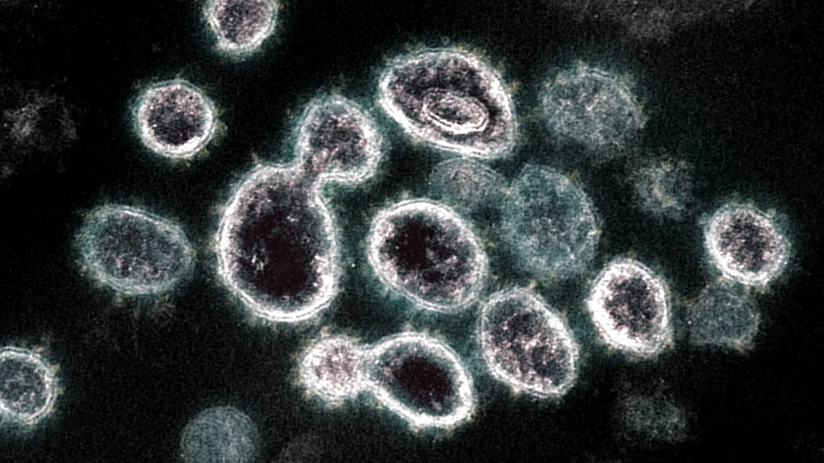 This transmission electron microscope image shows SARS-CoV-2, the virus that causes COVID-19, isolated from a patient in the U.S.