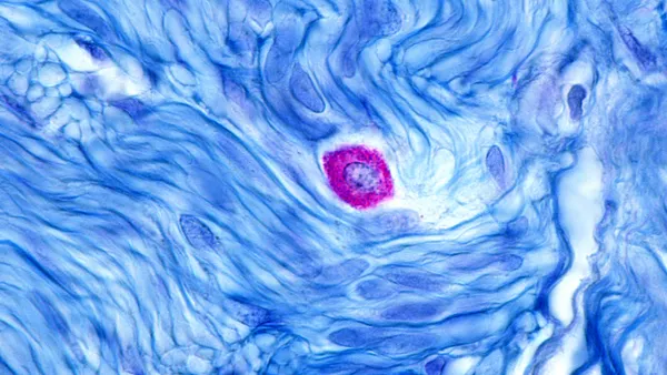 A micrograph of a mast cell or mastocyte, with smooth muscle fibers stained in blue.