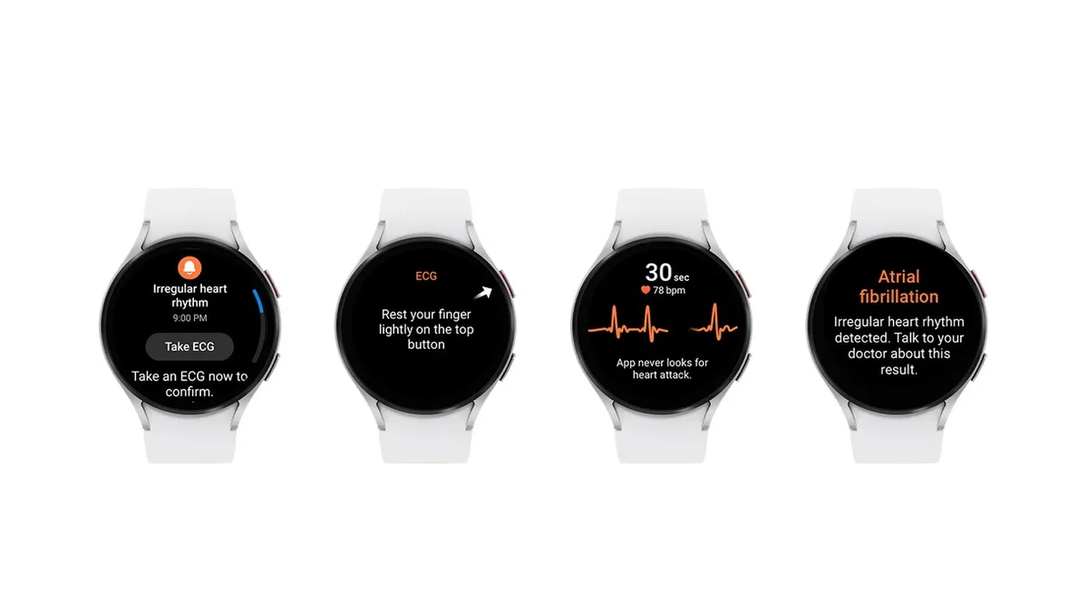 Four watch screens show from left to right: An irregular heart rhythm notification, a prompt for an ECG, a person's heart rhythm, and atrial fibrillation detected.