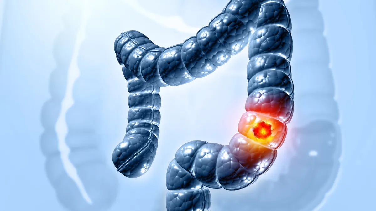 An illustration of pain in the colon.