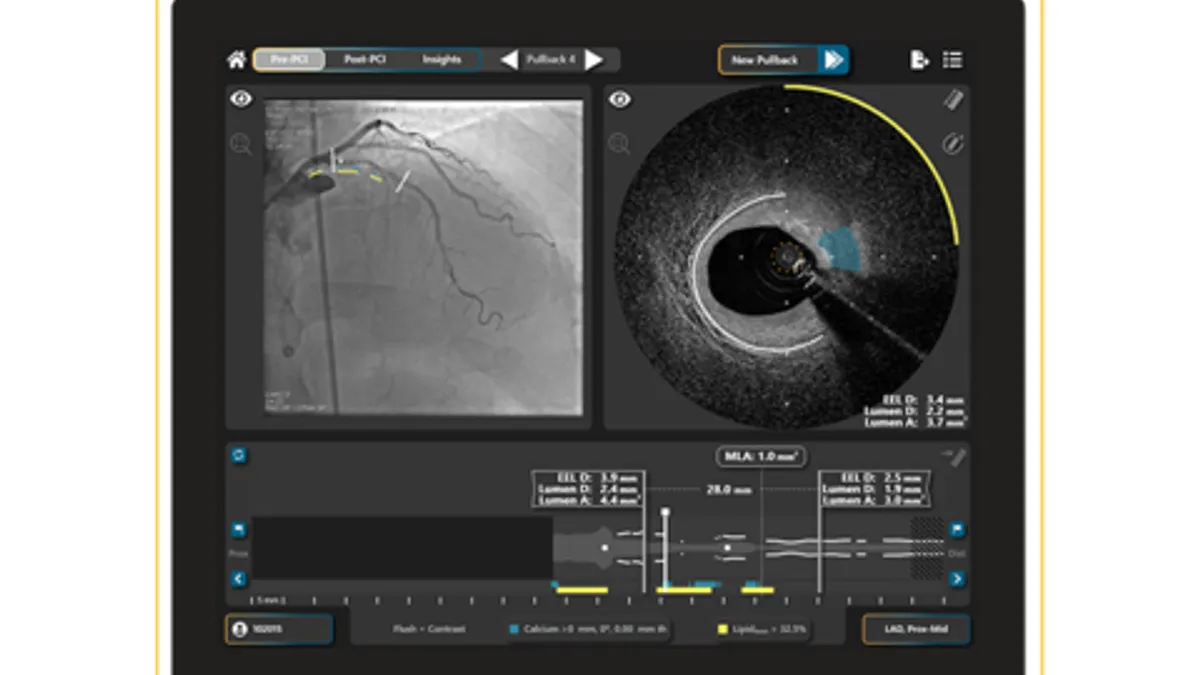 An image of Spectrawave's Hypervue intravascular imaging system.