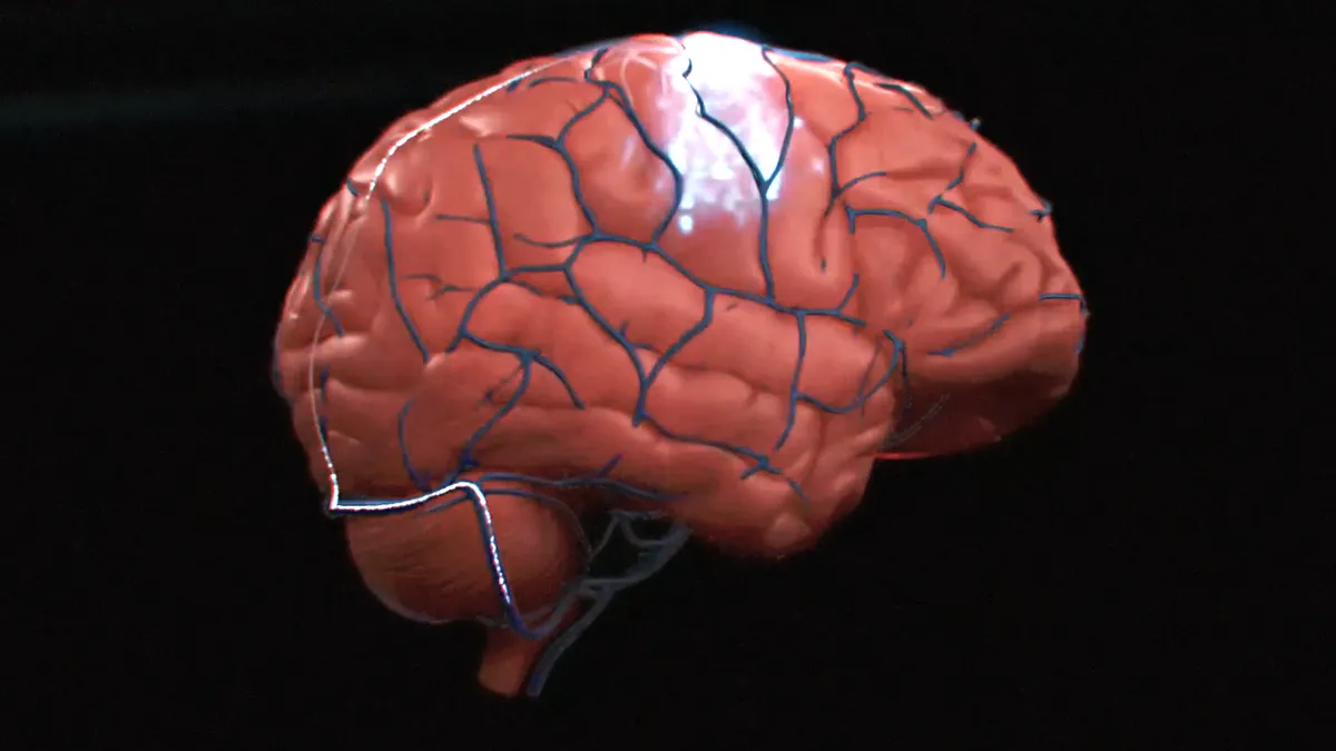 Model of brain with BCI implant