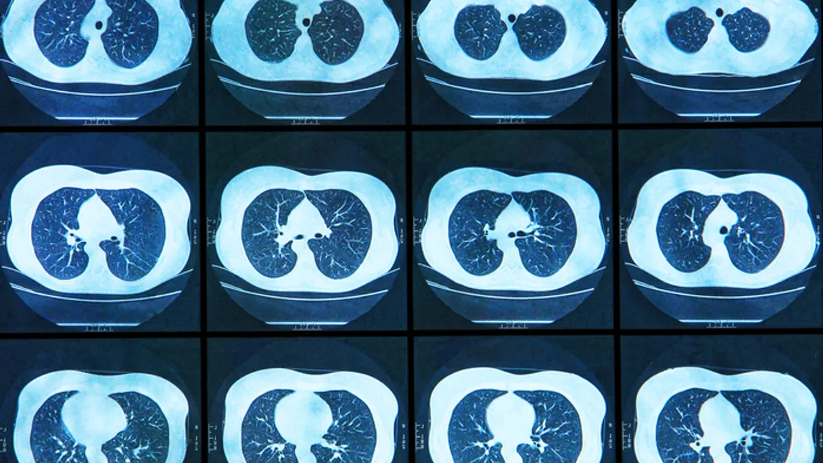 MRI images of the lungs are back lit on a screen for review