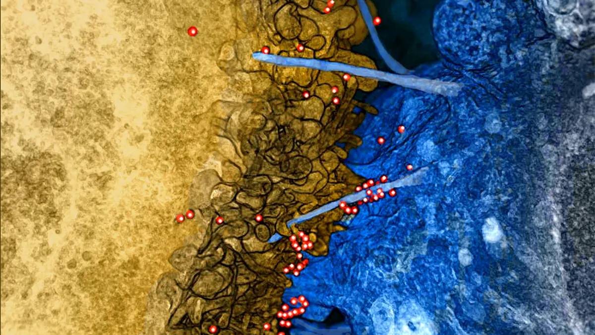 HIV on Bridges Between Infected Immune Cell and Uninfected Brain Cell