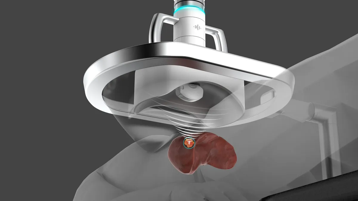 A rendering of the HistoSonics machine for blasting liver turmors