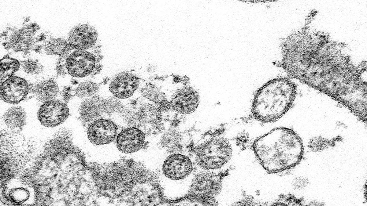 covid-19 coronavirus microscopic image