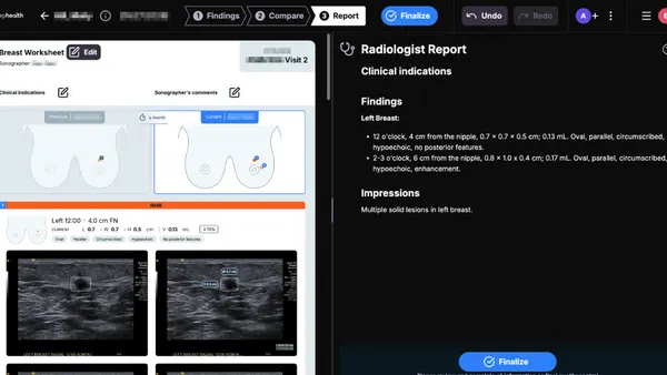 Images on the left side of a screen show tissue from a breast ultrasound, while the right screen shows a radiologist report with findings written out.