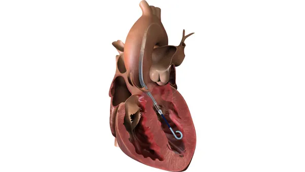 Johnson & Johnson's Impella CP heart pump is shown in an illustration of the heart.