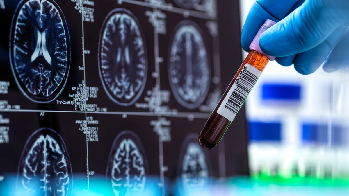 Alzheimer's research