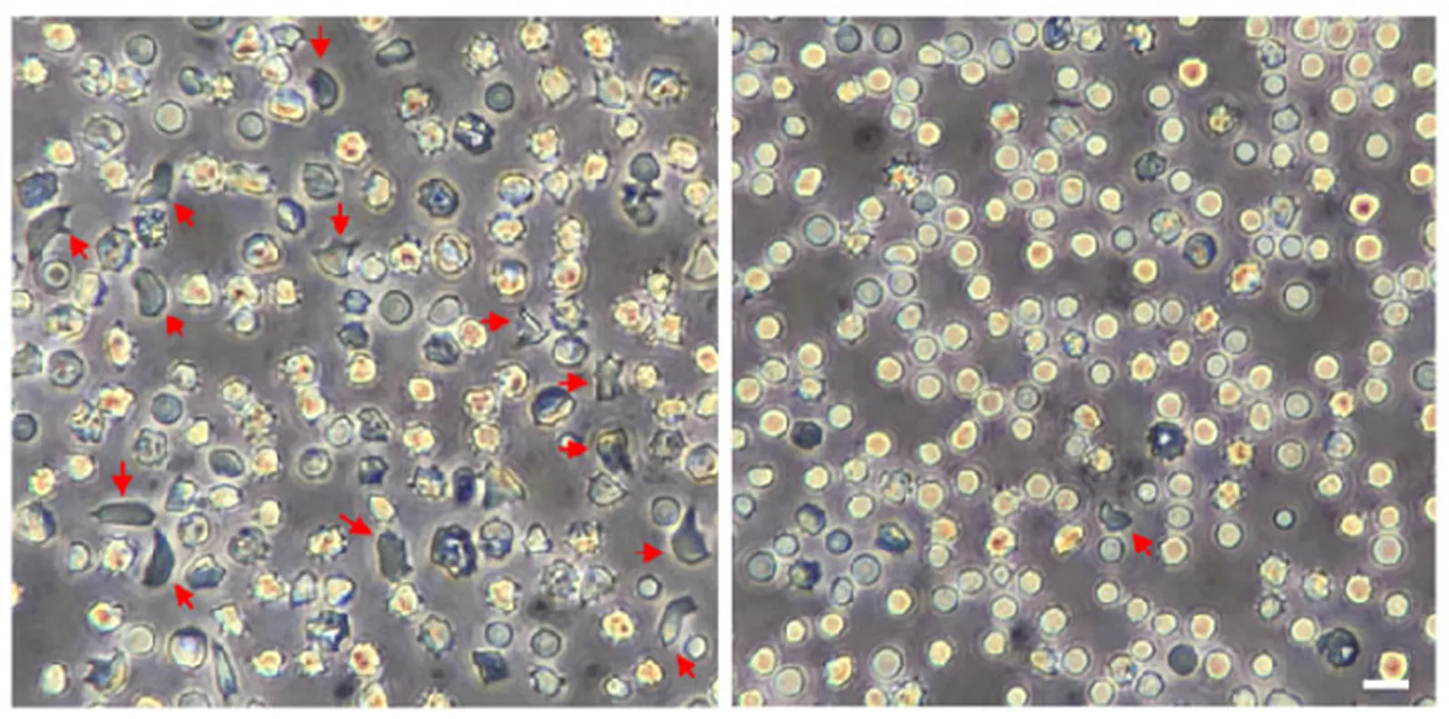 Sickled red blood cells are identified by arrows in this microscope image comparison of unedited and edited cells.