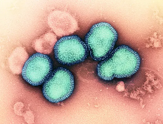 Cidara stock soars as antiviral drug succeeds in flu study