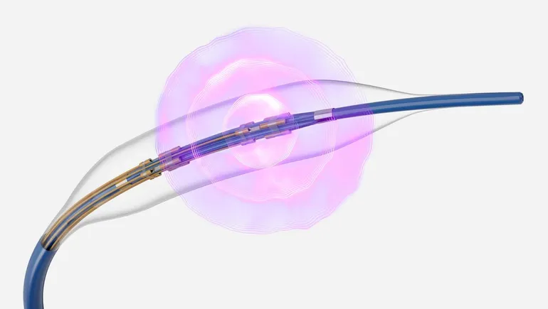 Boston Scientific posts positive data for coronary IVL catheter
