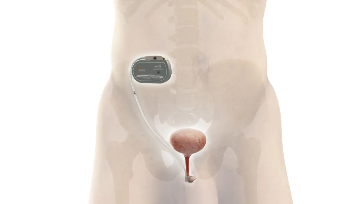 image of a UroMems mechatronics technology to treat stress urinary incontinence