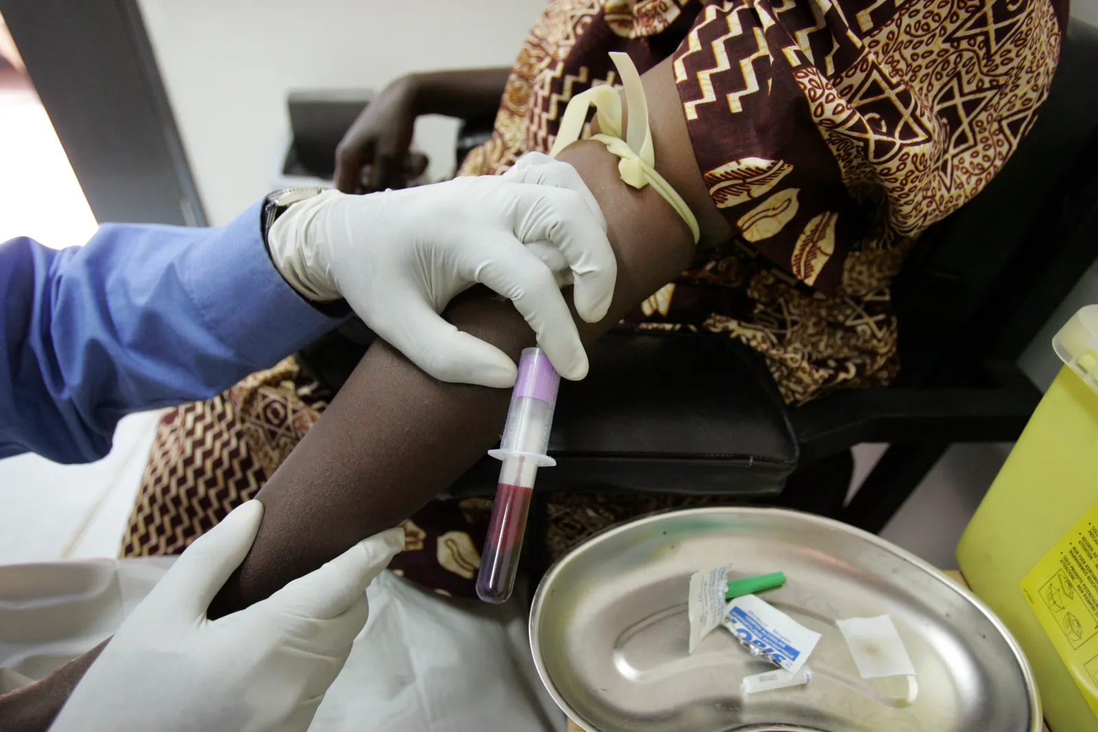 A laboratory technician collects blood for an HIV test from a patient in Kampala, Uganda.