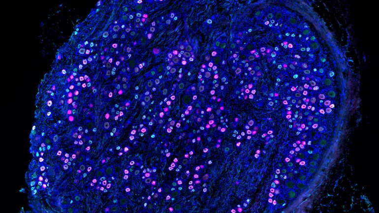A year after Vertex’s big launch, pain drug research faces a pivotal moment