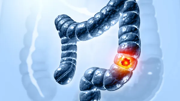 An illustration of pain in the colon.