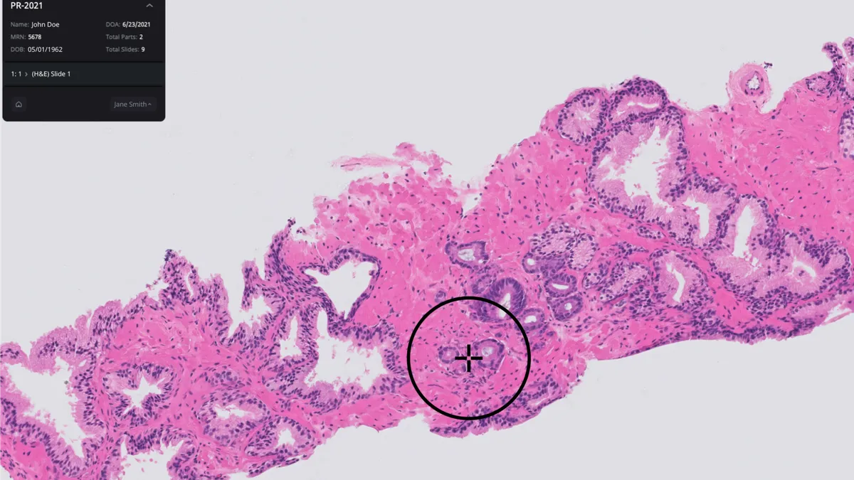 A pink stained tissue slide has a black circle with a crosshairs pointing to a segment of tissue and a patient's name and date of birth in the corner.