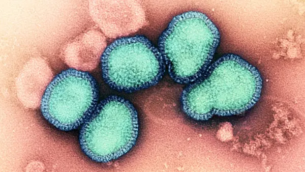 A micrograph image of influenza A virus.