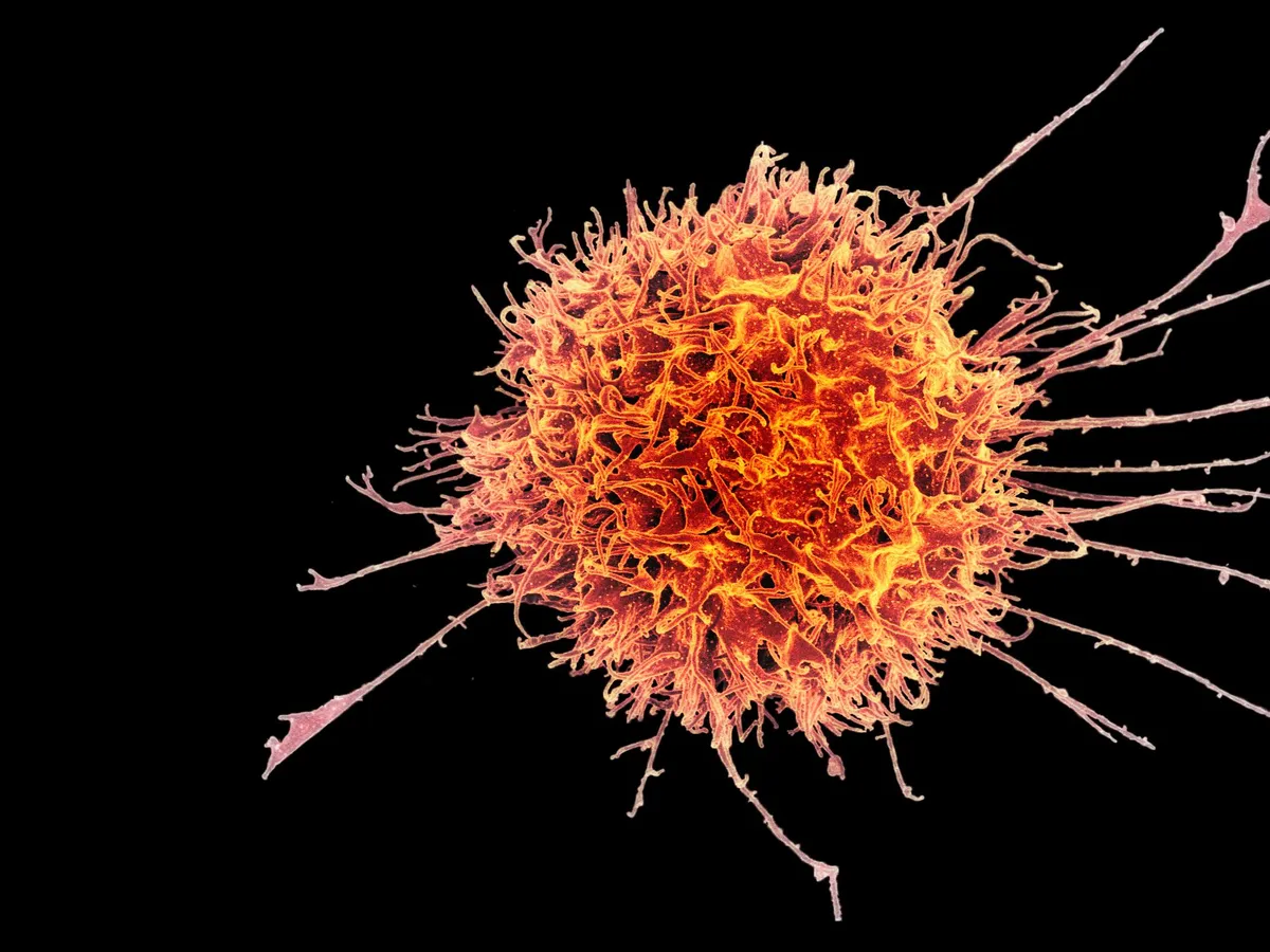 A cancer biotech attracts another deep-pocketed partner in Gilead