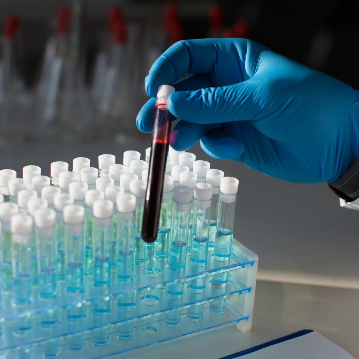 Tempus to acquire cancer test maker Personalis for $1.5B