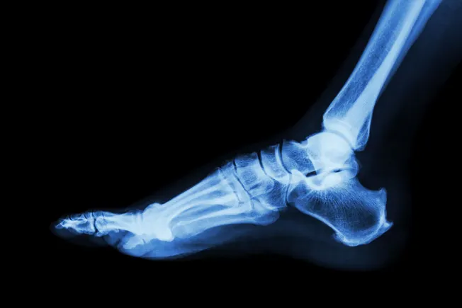 Teledyne inks $1.1B takeover of Varex Imaging