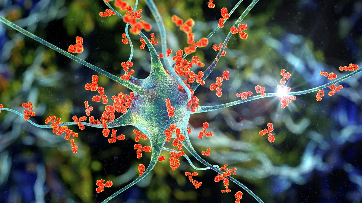 An illustration of antibodies attacking a nerve cell.