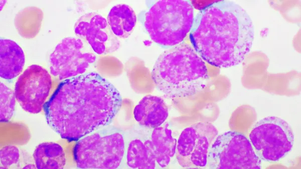 A microscopic image of chronic myeloid leukemia cells, magnified 1000 times.