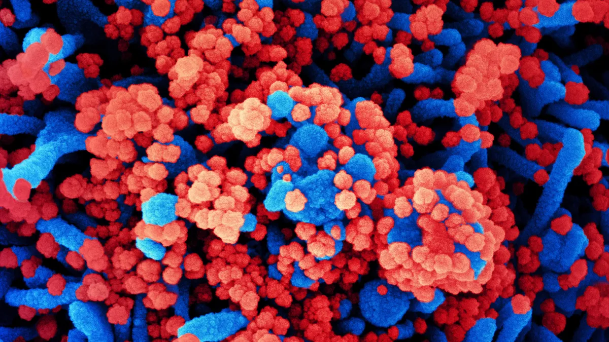 Colorized scanning electron micrograph of a cell heavily infected with SARS-CoV-2 virus particles, isolated from a patient sample