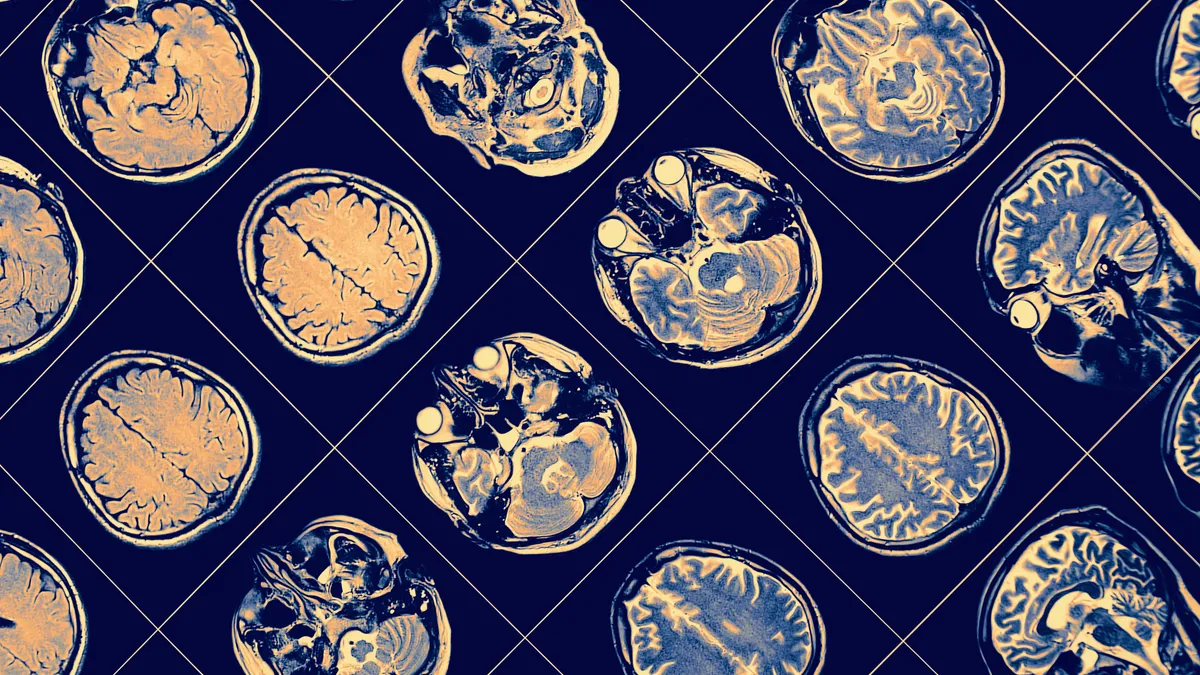 Brain scans are seen in a stock image