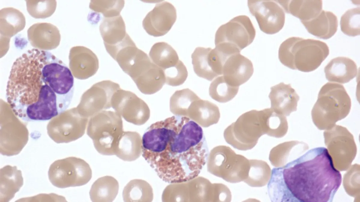 Activated eosinophils in the peripheral blood of a patient with idiopathic hypereosinophilic syndrome.